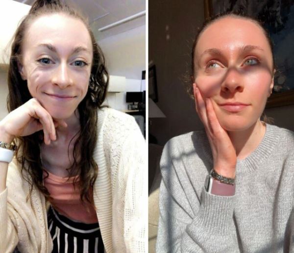 Впечатляющие преображения, которые вызовут улыбку (20 фото)