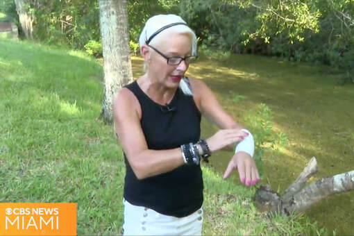 В США женщина голыми руками отбилась от аллигатора, напавшего на ее щенка