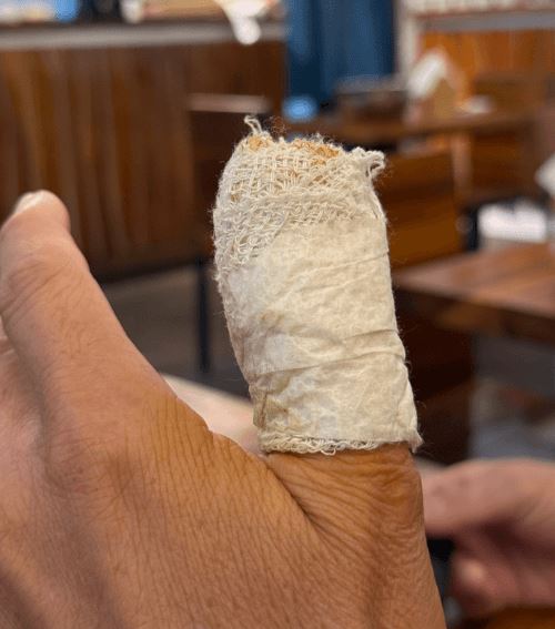 Пациенту, порезавшему палец, выдали использованный тюбик глазной мази