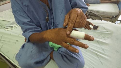 Ядовитая змея укусила женщину, принявшую её яйца за грибы