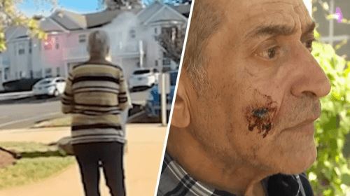 Пожилая женщина выстрелила соседу в лицо из ракетницы